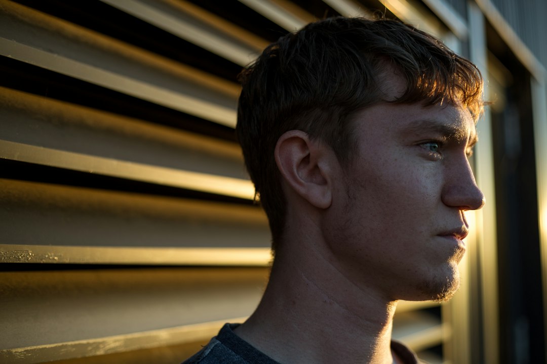 Balding at 25: How Common It Is and What to Weigh