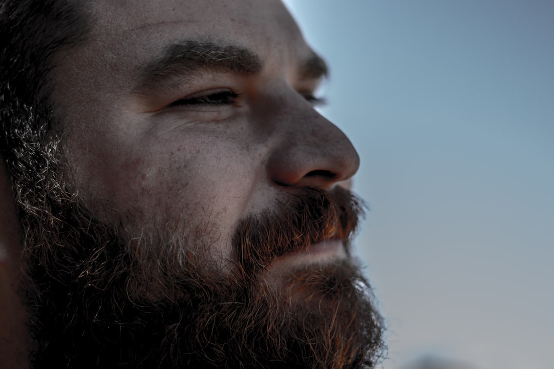 Beard Transplant: Grafts, Cost and the Donor Trade-Off