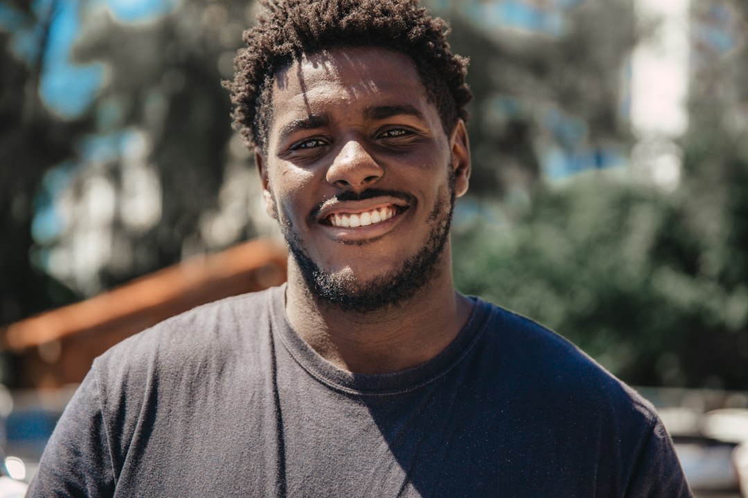 Black Male Hair Transplant: FUE, Keloids and Grafts