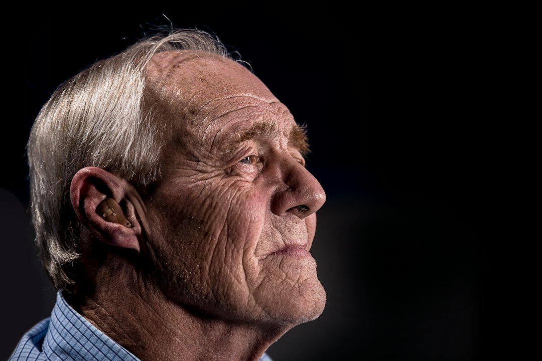 Hair Transplant Age: Minimum, Best Age and Upper Limit